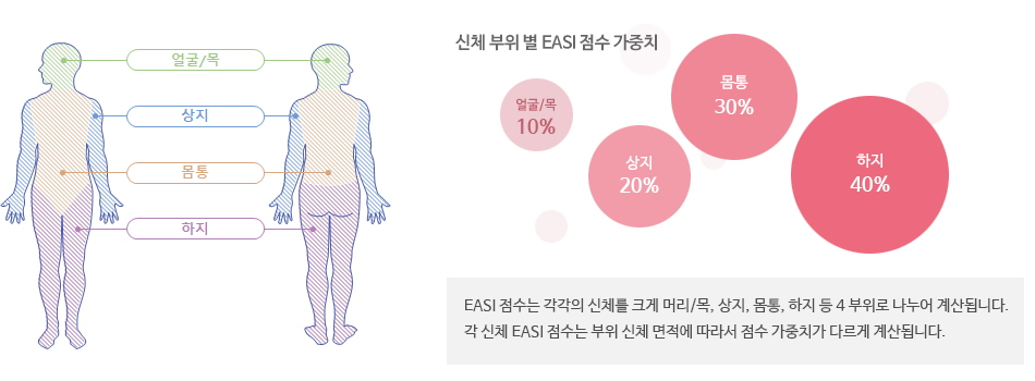 신체 부위 나누기, 신체 부위 별 EASI 점수 가중치